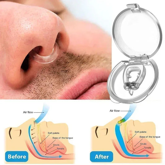 Effective Anti-Snoring Devices for peaceful nights.